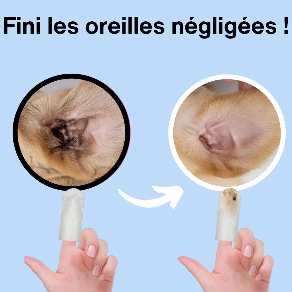 OriClean™ | Lingettes nettoyantes pour oreilles